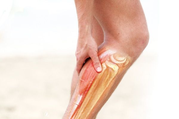 how to treat leg cramps
