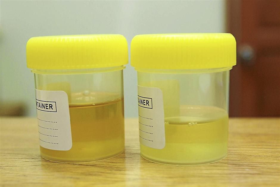 urine color odour