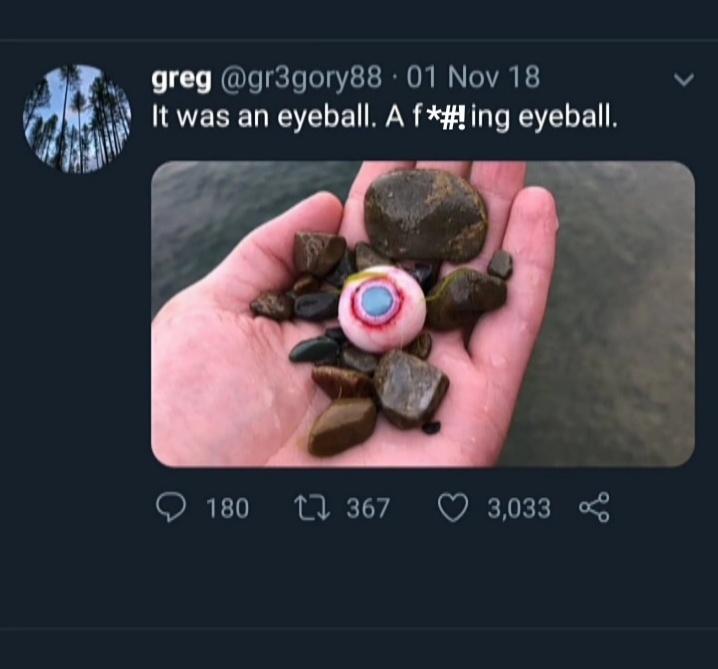  A Strange eyeball  