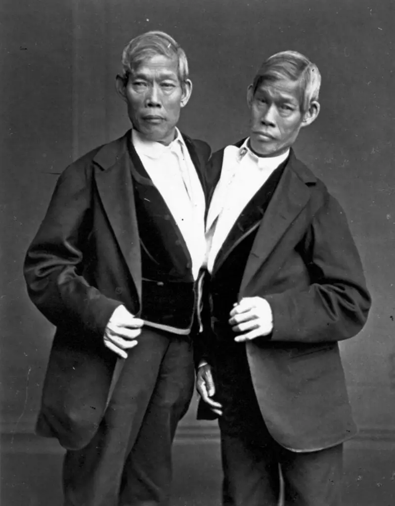 the original siamese twins