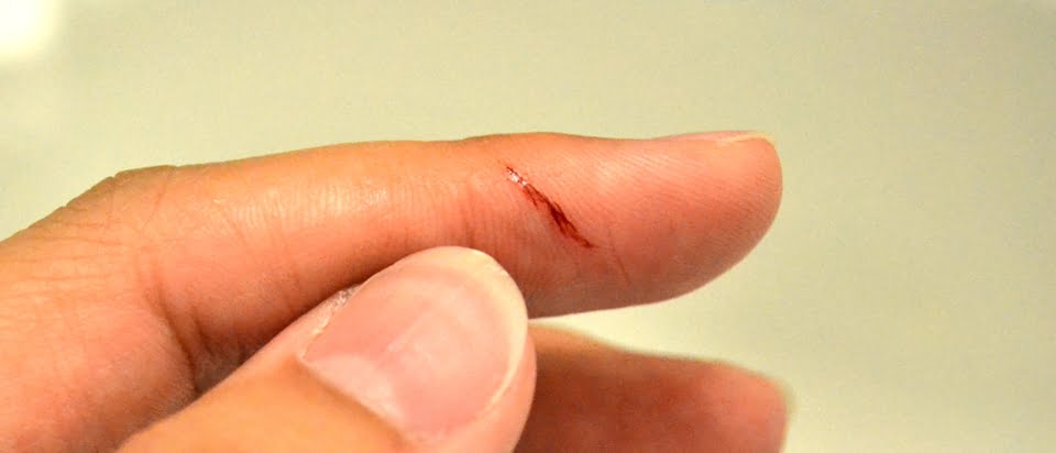 paper cut on fingers